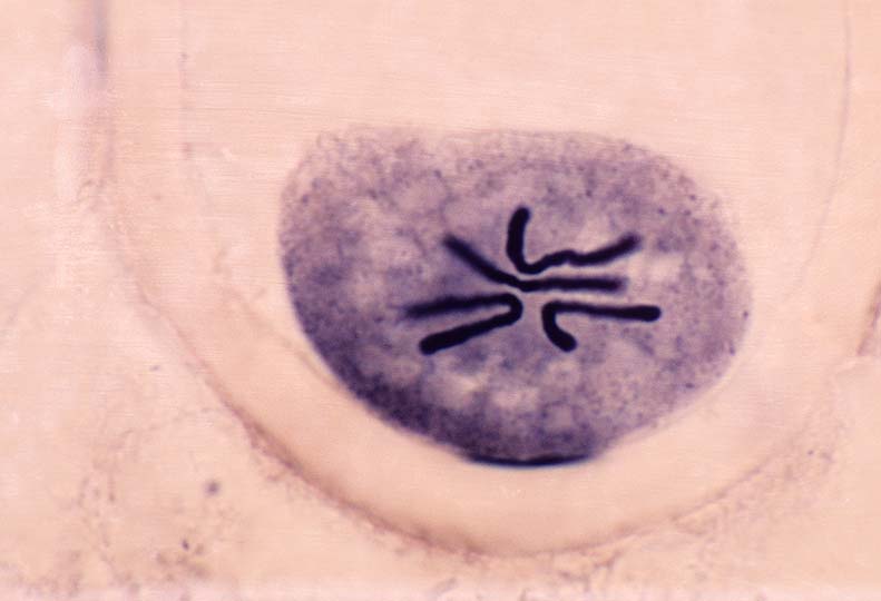 Cromossomos e cromatina